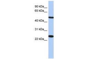 Image no. 1 for anti-Transmembrane Protein 161B (TMEM161B) (AA 71-120) antibody (ABIN6741235) (TMEM161B Antikörper  (AA 71-120))