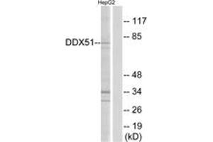 Western blot analysis of extracts from HepG2 cells, using DDX51 Antibody. (DDX51 Antikörper  (AA 617-666))