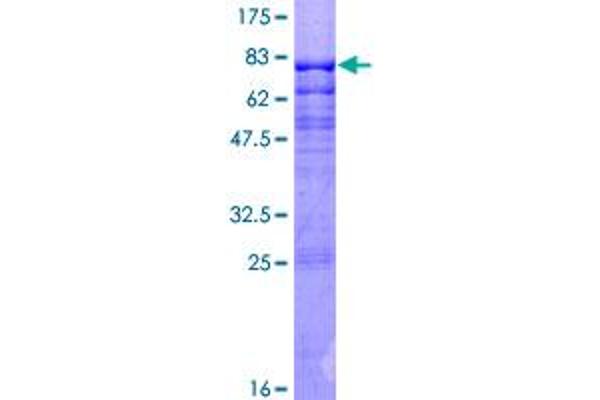 MEF2C Protein (AA 1-469) (GST tag)