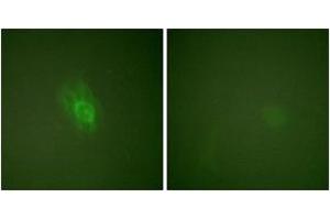 Immunofluorescence analysis of HeLa cells treated with TNF-a 20nM 15', using IkappaB-beta (Phospho-Ser23) Antibody. (NFKBIB Antikörper  (pSer23))