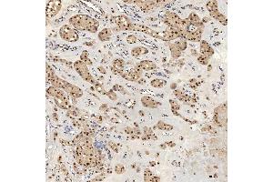 IHC analysis of U1A/SNRPA using anti-U1A/SNRPA antibody (ABIN7600891). (SNRPA1 Antikörper  (AA 25-218))
