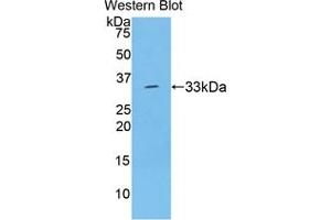 Western blot analysis of recombinant Rat TBG. (SERPINA7 Antikörper  (AA 114-391))