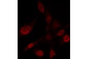 ABIN6272432 staining Hela by IF/ICC. (Sp3/4 Antikörper)