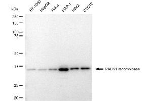 Western blotting analysis using RAD51 recombinase antibody (ABIN7798367). (Rekombinanter RAD51 Antikörper)