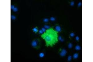 Anti-PEX5 mouse monoclonal antibody (ABIN2453449) immunofluorescent staining of COS7 cells transiently transfected by pCMV6-ENTRY PEX5 (RC202062). (PEX5 Antikörper)