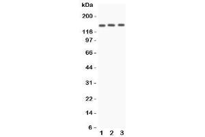 Western blot testing of Angiotensin Converting Enzyme antibody and Lane 1:  A549 (Angiotensin I Converting Enzyme 1 Antikörper  (N-Term))
