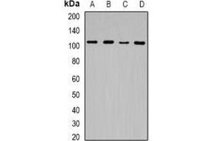 Western blot analysis of JHDM1D expression in Hela (A), HEK293T (B), mouse spleen (C), rat brain (D) whole cell lysates. (JHDM1D Antikörper)