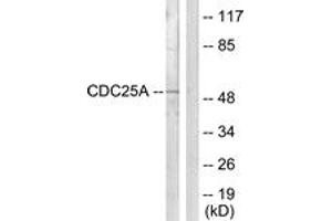 Western blot analysis of extracts from HepG2 cells, using CDC25A (Ab-124) Antibody. (CDC25A Antikörper  (AA 90-139))