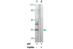 Western blot analysis of extracts from HUVEC cells, treated with EGF (200 ng/ml, 5 mins), using HNRNPC polyclonal antibody . (HNRNPC Antikörper  (Ser260))
