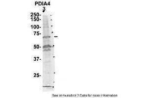 Sample Type: 3. (PDIA4 Antikörper  (N-Term))