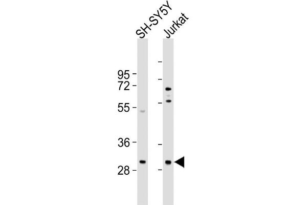 TRMT61A Antikörper  (N-Term)