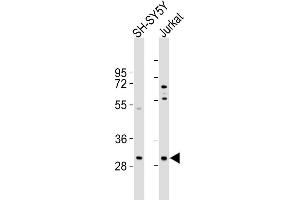 TRMT61A antibody  (N-Term)