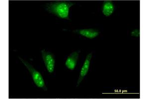 Immunofluorescence of monoclonal antibody to TAF7L on HeLa cell.