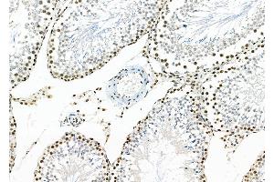 ABIN6259030 and ABIN6273465 at 1/100 staining Rat testis tissue by IHC-P. (APITD1 Antikörper  (C-Term))