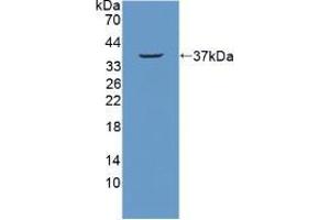 Western blot analysis of recombinant Mouse NUP214. (NUP214 Antikörper  (AA 601-868))