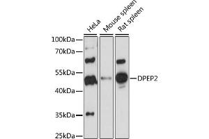 Western blot analysis of extracts of various cell lines, using DPEP2 antibody (ABIN7266781) at 1:1000 dilution. (DPEP2 Antikörper  (AA 400-463))