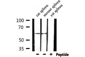 Western blot analysis of extracts from rat spleen,mouse spleen, using Cytochrome P450 2D6 Antibody.
