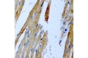 Immunohistochemical analysis of GnT-III staining in rat heart formalin fixed paraffin embedded tissue section.