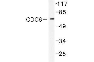 Image no. 1 for anti-Cell Division Cycle 6 Homolog (S. Cerevisiae) (CDC6) antibody (ABIN265343) (CDC6 Antikörper)
