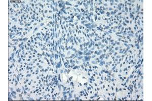 Immunohistochemical staining of paraffin-embedded endometrium tissue using anti-PDE10A mouse monoclonal antibody. (PDE10A Antikörper)
