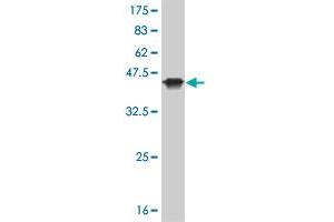Western Blot detection against Immunogen (36. (KAT2B Antikörper  (AA 353-452))