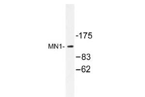 Image no. 1 for anti-MN1 proto-oncogene (MN1) antibody (ABIN317611)