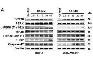 MCF-7 and MDA-MB-231 cells were treated with the indicated concentrations of BA for 24 h, and the protein levels of ER stress-associated signals were stimulated by BA in a dose-dependent manner, including GRP78, p-PERK/PERK, p-eIF2α/eIF2α, CHOP, and caspase-12.