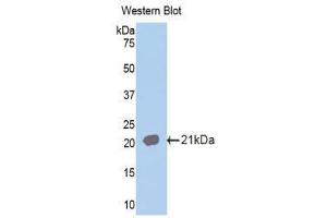 Western Blotting (WB) image for anti-Interleukin 18 Receptor 1 (IL18R1) (AA 391-518) antibody (ABIN1859373) (IL18R1 Antikörper  (AA 391-518))