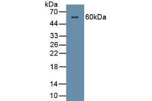 Detection of Recombinant CDSN, Human using Polyclonal Antibody to Corneodesmosin (CDSN) (Corneodesmosin Antikörper  (AA 33-300))