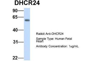 Host:  Rabbit  Target Name:  DHCR24  Sample Type:  Human Fetal Heart  Antibody Dilution:  1.