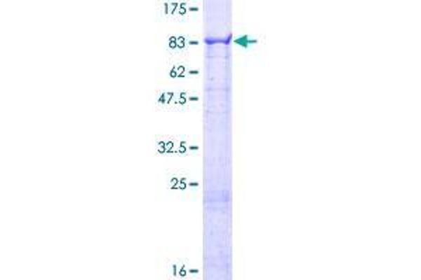 CFHR5 Protein (AA 1-569) (GST tag)