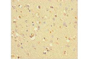 Immunohistochemistry of paraffin-embedded human brain tissue using ABIN7148316 at dilution of 1:100 (COMMD6 Antikörper  (AA 1-85))