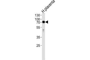 Western Blotting (WB) image for anti-Alkaline Phosphatase (ALP) antibody (ABIN2998256) (Alkaline Phosphatase Antikörper)