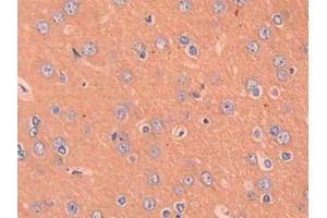 DAB staining on IHC-P; Samples: Rat Cerebrum Tissue (CCL4 Antikörper  (AA 24-92))