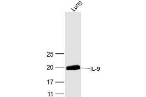 Mouse lung lysates probed with IL-9 Polyclonal Antibody, Unconjugated  at 1:300 dilution and 4˚C overnight incubation. (IL-9 Antikörper  (AA 21-120))
