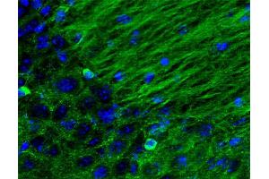 Immunohistochemistry (IHC) image for anti-tau Protein (AA 3-214) antibody (ABIN1742567) (tau Antikörper  (AA 3-214))