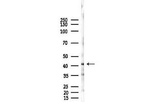 anti-SH3-Domain GRB2-Like Endophilin B1 (SH3GLB1) antibody