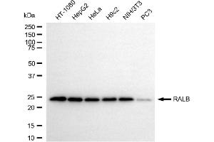 Western blotting analysis using RALB antibody (ABIN7800803).