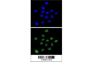 Confocal immunofluorescent analysis of DKC1 Antibody with 293 cell followed by Alexa Fluor 488-conjugated goat anti-rabbit lgG (green). (DKC1 Antikörper  (AA 185-213))