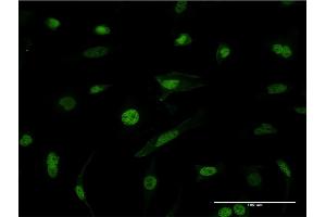 Immunofluorescence of monoclonal antibody to HNRNPM on HeLa cell. (HNRNPM Antikörper  (AA 17-112))