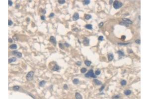 Immunohistochemistry (IHC) image for anti-N-Ethylmaleimide-Sensitive Factor (NSF) (AA 590-744) antibody (ABIN7440899)