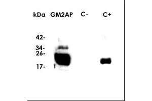 Western-Blot (Dilution 1:1000 in PBS) , kDA: molecular weight marker , GM2AP: recomb.