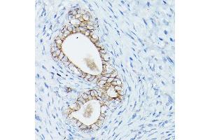Immunohistochemistry of paraffin-embedded rat uterus using δ-Catenin/p120 Catenin Rabbit pAb (ABIN3022308, ABIN3022309, ABIN3022310, ABIN1512791 and ABIN6218725) at dilution of 1:50 (40x lens). (CTNND1 Antikörper  (AA 573-832))