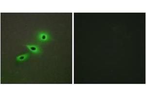 Immunofluorescence analysis of A549 cells, using Cytochrome P450 19A1 Antibody. (Aromatase Antikörper  (AA 221-270))