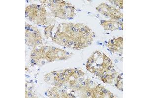 Immunohistochemistry of paraffin-embedded human gastric using FGF13 antibody at dilution of 1:100 (x40 lens). (FGF13 Antikörper)