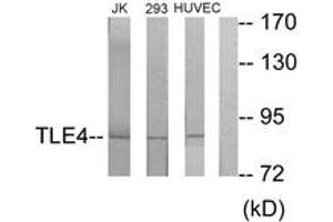 Western blot analysis of extracts from Jurkat/293/HuvEc cells, using TLE4 Antibody.