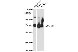 Western blot analysis of extracts of various cell lines, using GUCY1B3 antibody. (GUCY1B3 Antikörper)