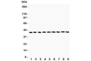 Western blot testing of APE1 antibody and Lane 1:  rat NRK;  2: human HeLa;  3: (r) PC12;  4: (r) RH35;  5: mouse HEPA;  6: (h) MCF7: (h) A549;  8: (h) placenta;  9: (h) A431. (APEX1 Antikörper  (AA 2-318))
