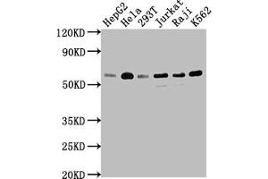 Western Blot Positive WB detected in: HepG2 whole cell lysate, Hela whole cell lysate, 293T whole cell lysate, Jurkat whole cell lysate, Raji whole cell lysate, K562 whole cell lysate All lanes: TRAF2 antibody at 1:1500 Secondary Goat polyclonal to rabbit IgG at 1/50000 dilution Predicted band size: 56, 62, 55, 54 kDa Observed band size: 56 kDa (Rekombinanter TRAF2 Antikörper)