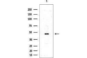 Western blot analysis of lysates from COLO205 cells(heat-shock treatment), using SSB Antibody at 1/1000 dilution.